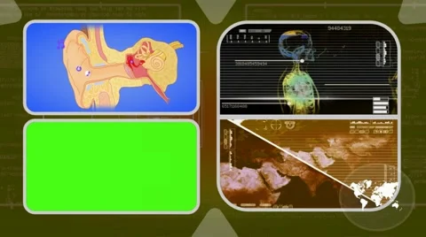 Ear - Analysis in software - examination - background yellow 02 Video stock 62463670