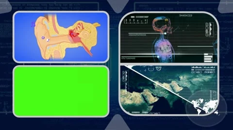 Ear - Analysis in software - examination - background blue 02 Video stock 62463708