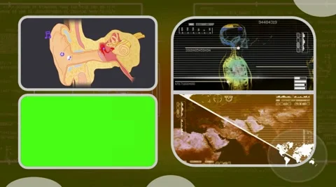 Ear - Analysis in software - examination - background yellow 03 Video stock 62463747