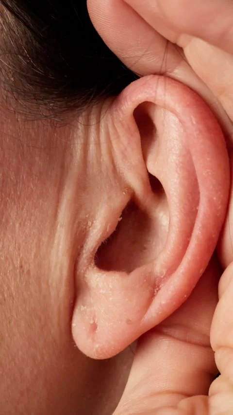 Ear Damage And Hear Problems, Damage Aid Stock Footage 302596536