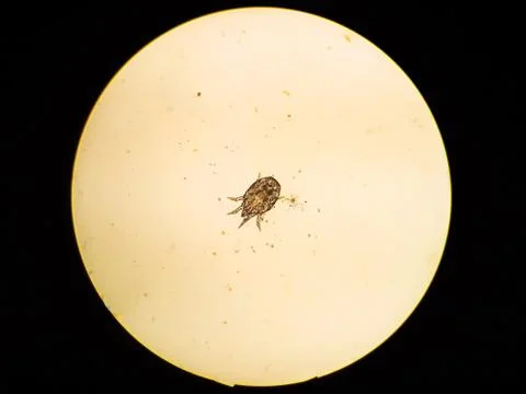 Ear mite from a cat, under the microscope Stock Photos