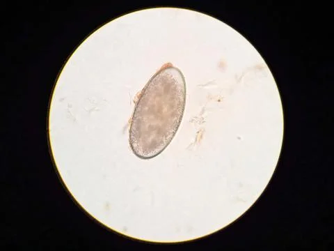 Ear mite egg from a cat, under the microscope Stock Photos