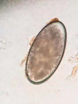 Ear mite egg from a cat, under the microscope Stock Photos