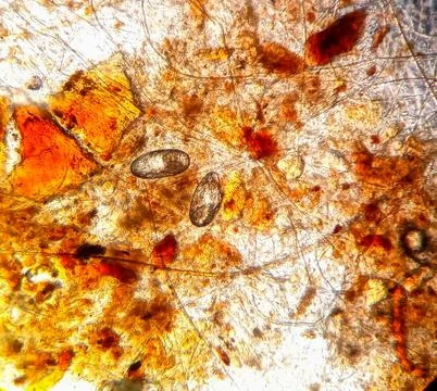Ear mite egg from a cat, under the microscope Stock Photos