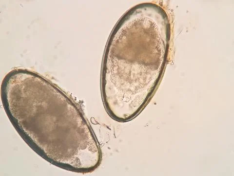 Ear mite egg from a cat, under the microscope Stock Photos