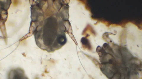 Ear Mite Pregnant Stock Footage 33847096