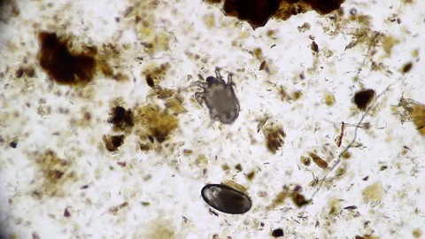 Ear mite under microscope Stock Footage 120949303