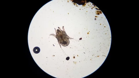Ear mite under microscope Stock Footage 120950026