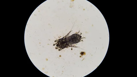 ear mites under microscope | Stock Video | Pond5