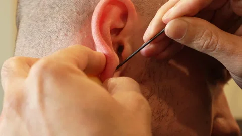 Ear piercing procedure for earring insertion, close-up Stock Footage 312522504
