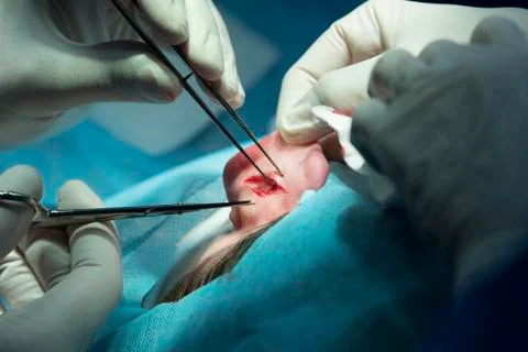 Ear Surgery Stockfoto's