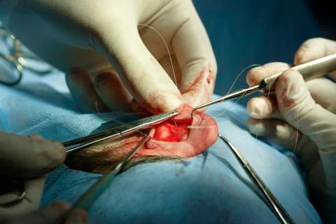 Ear surgery Stockfoto's