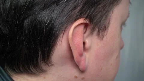 The ear of a young man in close-up Stock Footage 168687683