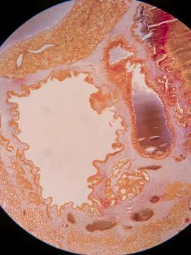 Earthworm Cross-Section Stock Photos