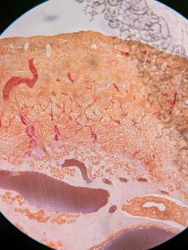 Earthworm Cross-Section Stock Photos