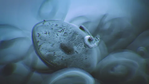 Ebola 動画素材 131979667