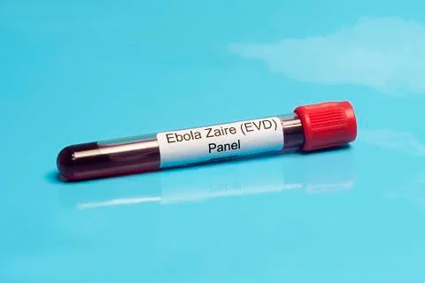 Ebola lab panel Stock Photos