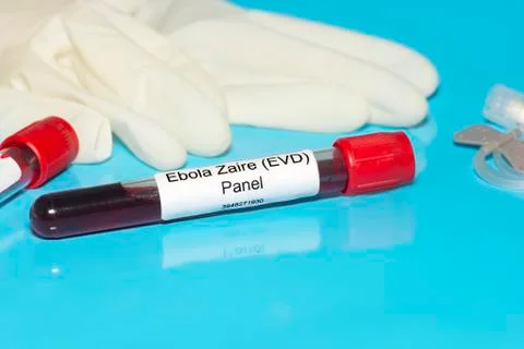 Ebola lab panel Stock Photos