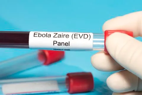 Ebola lab panel Stock Photos