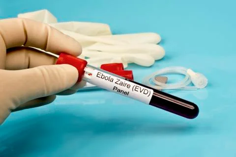 Ebola lab panel Stock Photos