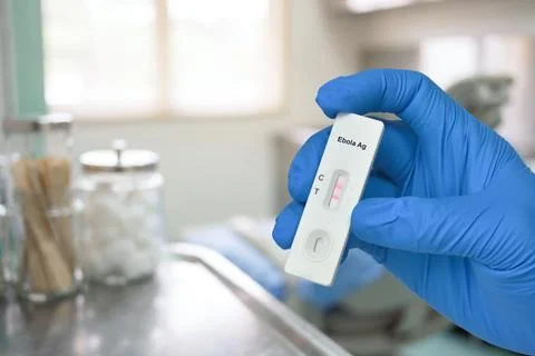 Ebola Rapid Antigen Diagnostic Test Positive Stock Photos