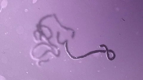 Ebola static floating under microscope Stock Footage 40728070