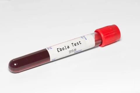 Ebola test Stock Photos