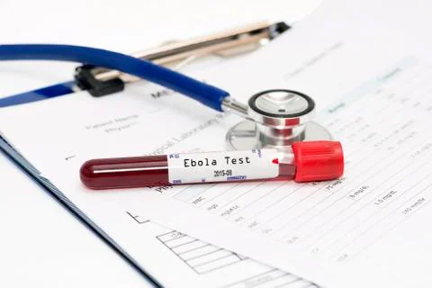 Ebola test Stock Photos