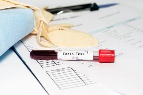Ebola test Stock Photos