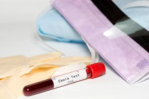 Ebola test Stock Photos