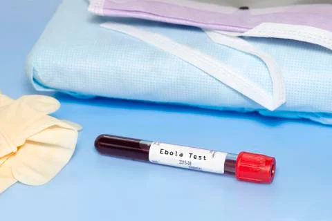 Ebola test Stock Photos
