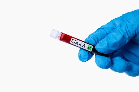 Ebola Virus Blood Sample Test Tube in Gloved Hand 写真素材