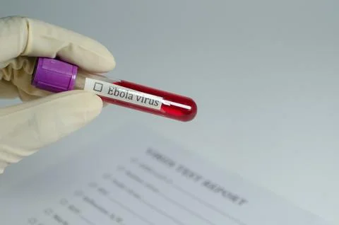 Ebola Virus Blood Sample on Test Report Form Stock Photos