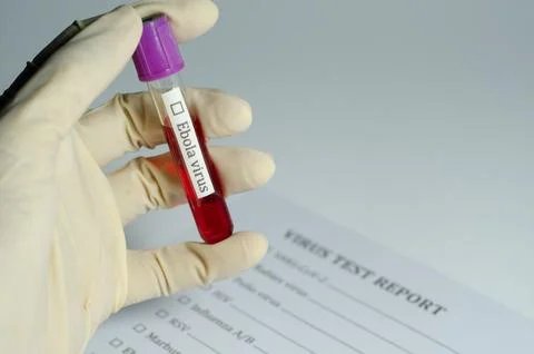 Ebola Virus Blood Sample on Test Report Form Stock Photos