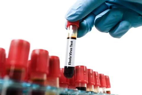 Ebola Virus Blood Test Sample Stock Photos