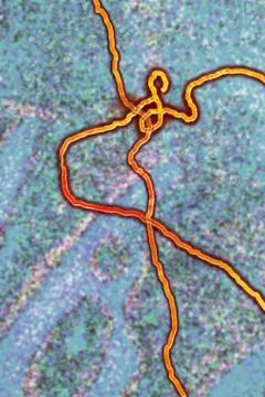 Ebola Virus Stock Illustration