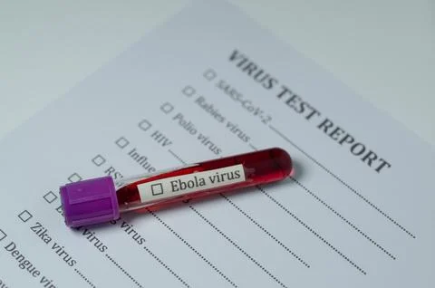 Ebola Virus Test Sample and Report Document Stock Photos