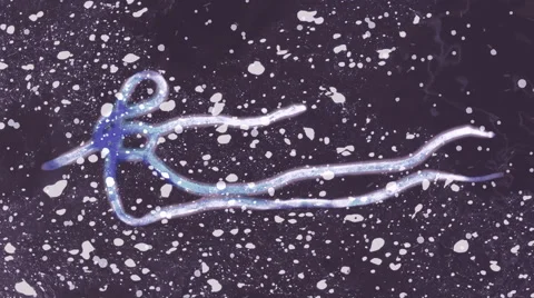 The Ebola Virus viewed under a high powered microscope Stock Footage 41455339