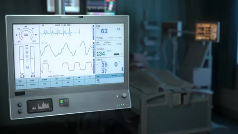 ECG Alerts Of Patient Dying From Rapid Decrease Of Heart Rate And Breath Stock Footage