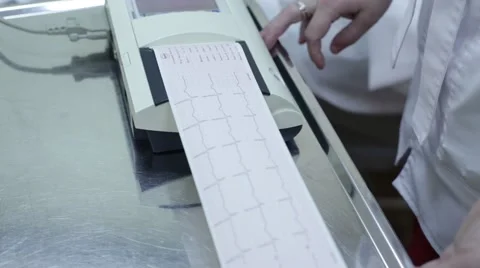 ECG. Cardiogram. Electrocardiography Stock Footage 62763894
