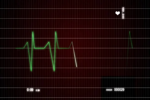 ECG Cardiovascular heart monitor Stock After Effects