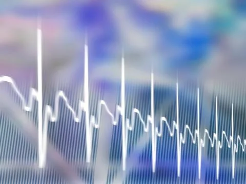 Ecg, computer artwork Illustrazione stock
