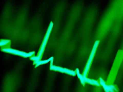Ecg, computer artwork Stock Illustration