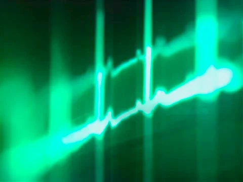 Ecg, computer artwork Illustrazione stock