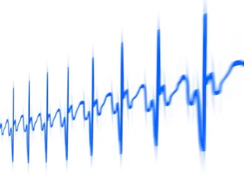 ECG; computer artwork Illustrazione stock