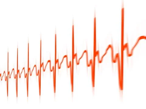 ECG; computer artwork Illustrazione stock