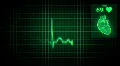 ECG diagram with three parts - 1 part 10 seconds HD Footage