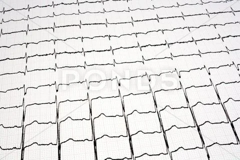 Ecg - ekg graph Stock Photos