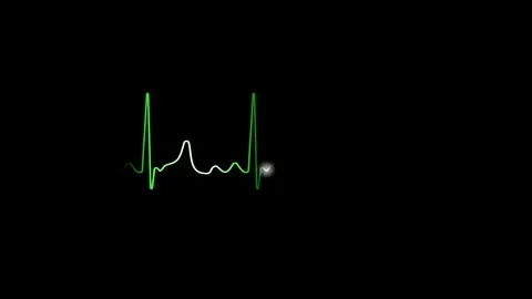 Heart Rate Graphic Stock Video Footage | Royalty Free Heart Rate ...