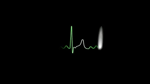 ECG / EKG Monitor Motion Graphic - 50bpm to Flat Line Heart Rate Stock Footage